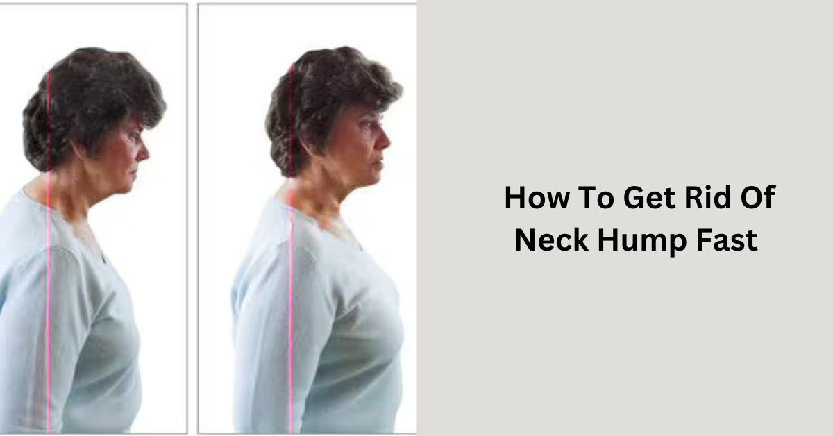 How To Get Rid Of Neck Hump Fast